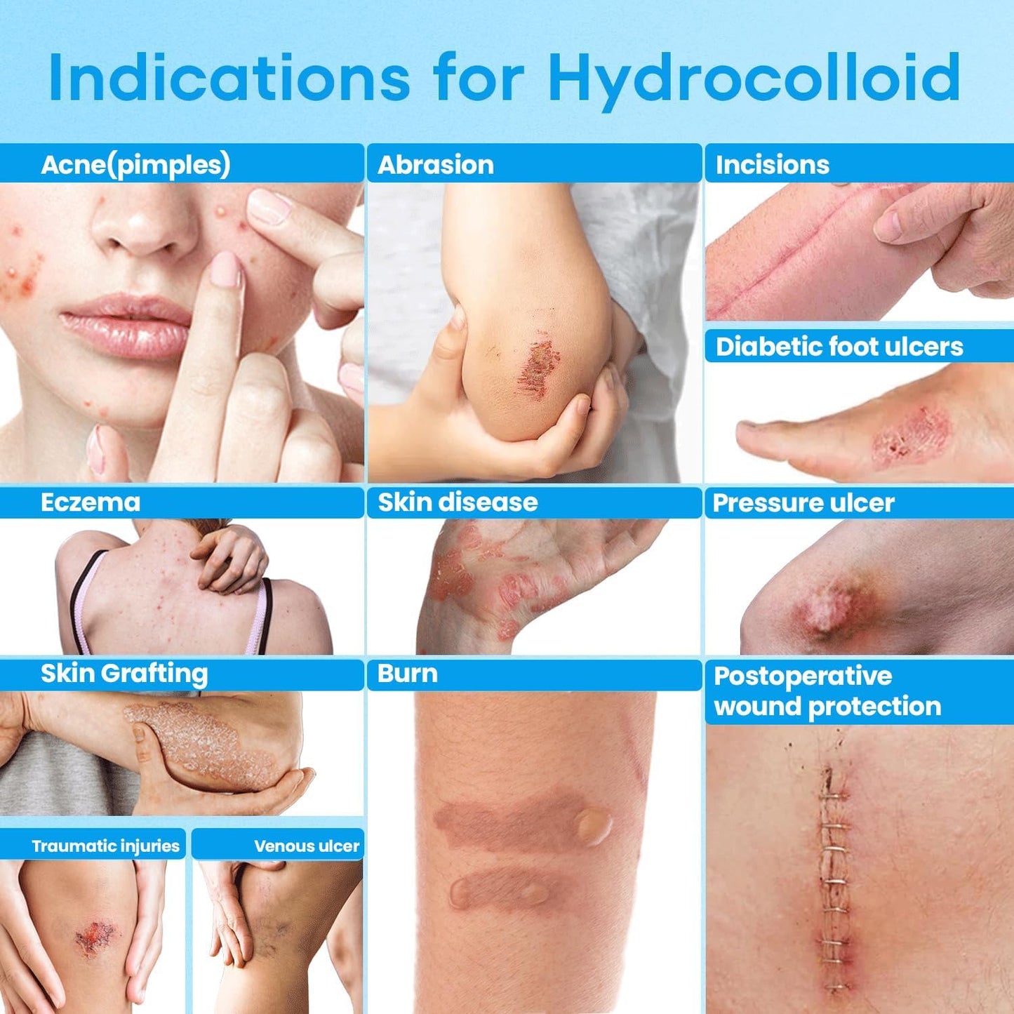 Hydrocolloid Healing Roll