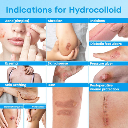 Hydrocolloid Healing Roll