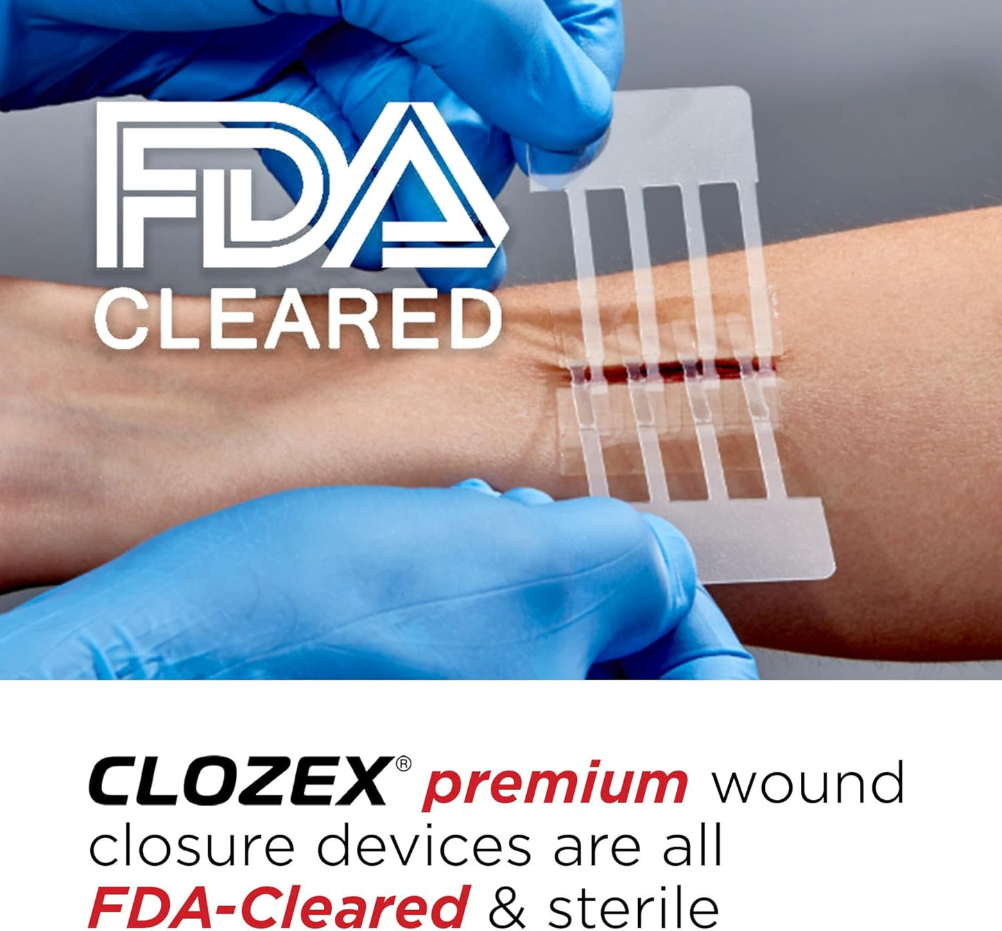 Emergency Laceration Closures