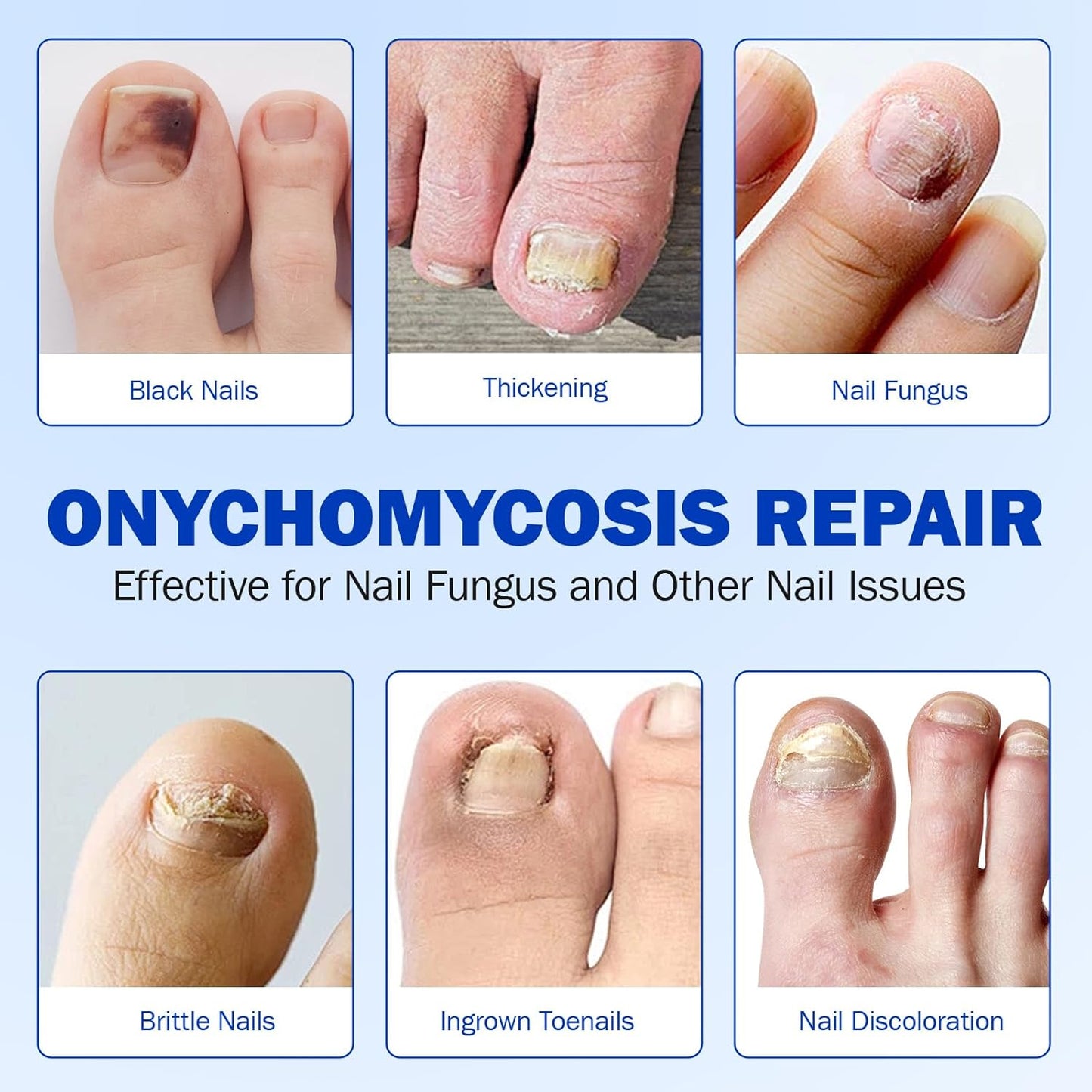 Revive Your Toenails™