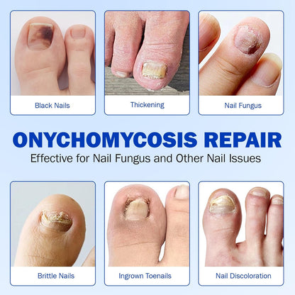 Revive Your Toenails™