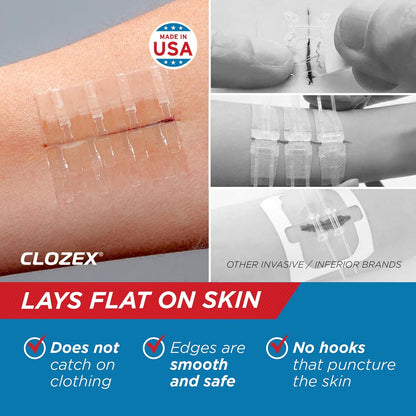 Emergency Laceration Closures