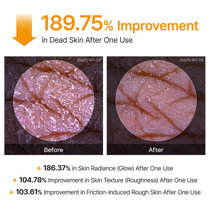 Body Peel Shot Spray